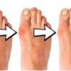 Silicone Hammer Toe Corrector